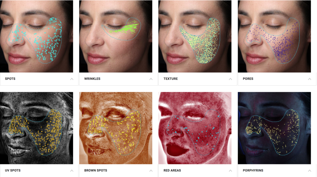 Visia Skin Analysis Evaluation Report Rejuvenation