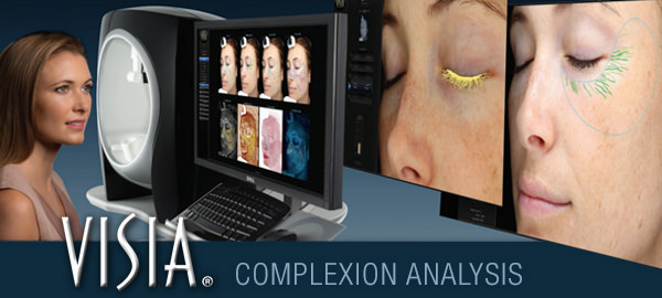 Visia Skin Analysis Skin Test