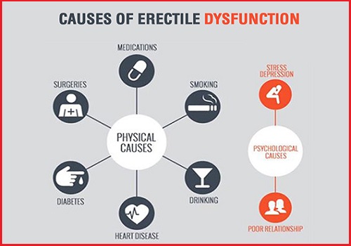 Erectile Dysfunction Causes Los Angeles Pasadena Peyronies Disease Ed